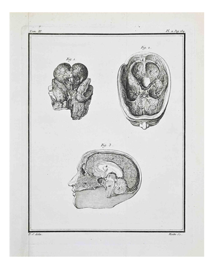 Jacques Baron, Anatomical Studies, Human Brain, Etching, 1771