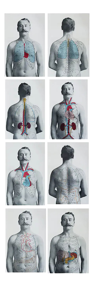 Vintage Medical Prints, 1900, Set of 8, Paper