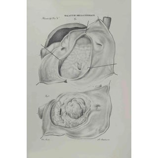 Ottavio Muzzi, Stomach Diseases, Lithograph, 1843 For Sale
