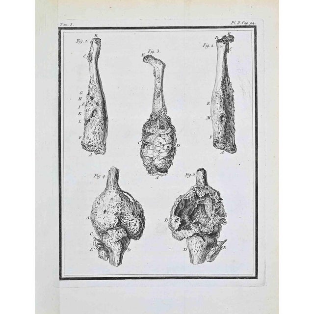 Jacques de Seve, Anatomical Studies, Etching, 1771 For Sale