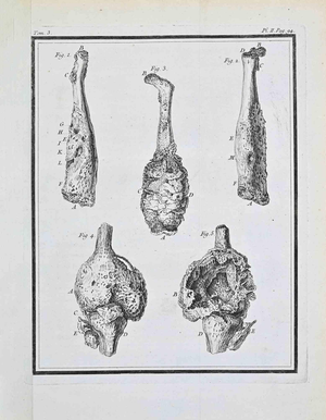 Jacques de Seve, Anatomical Studies, Etching, 1771
