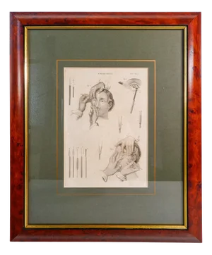 C. Pastore, Ophthalmic Surgery, Italy, 1800, Print