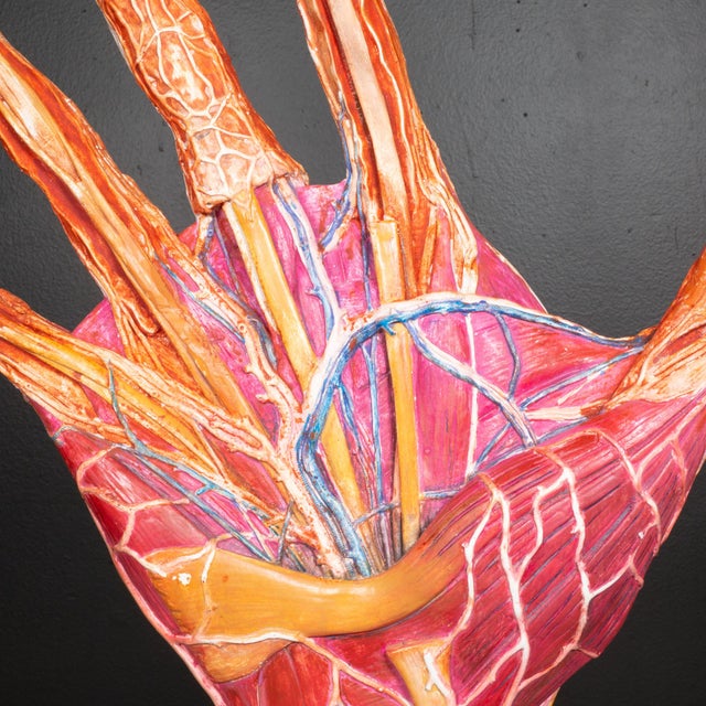 ABOUT Early 20th century large French plaster hand model used as a medical teaching device. Lacquered plaster custom heavy...
