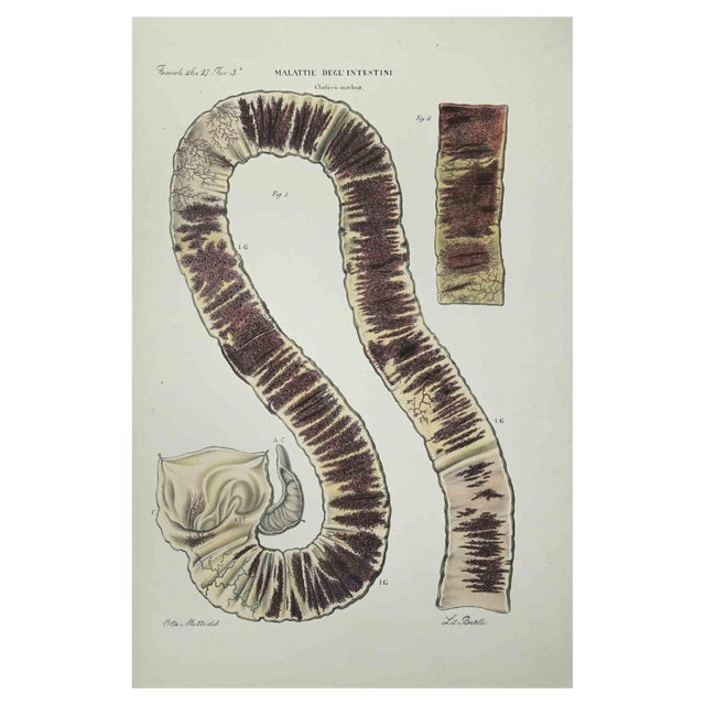 Ottavio Muzzi, Bowel Diseases, Lithograph, 1843 For Sale