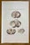 Diseases of the Cerebellum is a lithograph hand colored by Ottavio Muzzi for the edition of Antoine Chazal, Human Anatomy,...