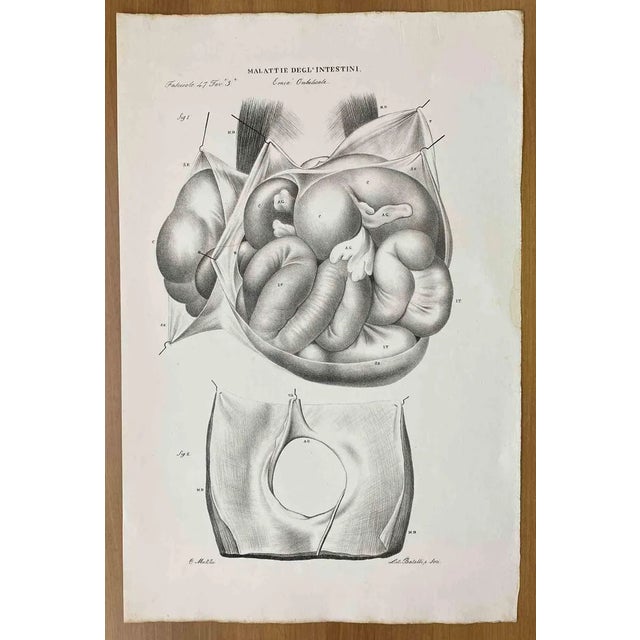 Ottavio Muzzi, Intestinal Diseases, Lithograph, 1843 For Sale