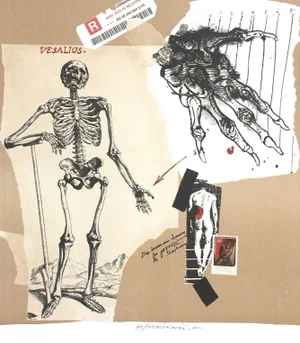 2007 Vladimir Velickovic Vesalius Lithograph