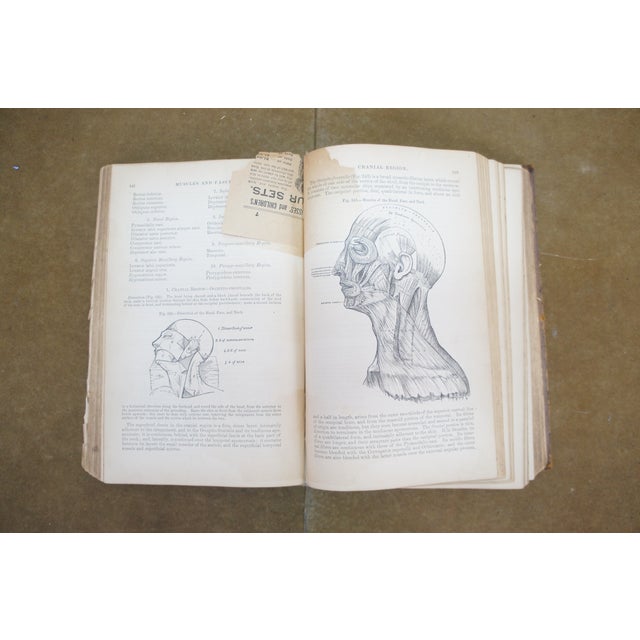 Antique 1878 Grays Anatomy Descriptive Surgical Medical Book Henry C Lea Leather For Sale - Image 13 of 16