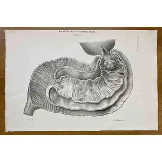 Ottavio Muzzi, Small Intestine Disease, Lithograph, 1843 For Sale