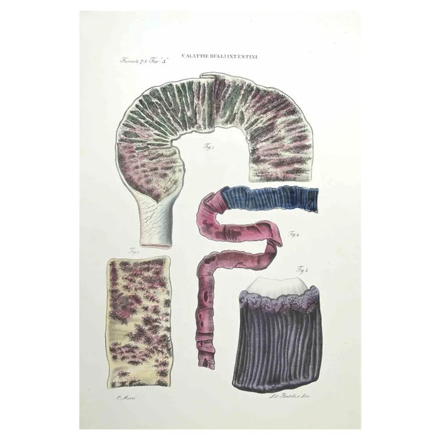 Ottavio Muzzi, Diseases of the Intestines, Lithograph, 1843 For Sale
