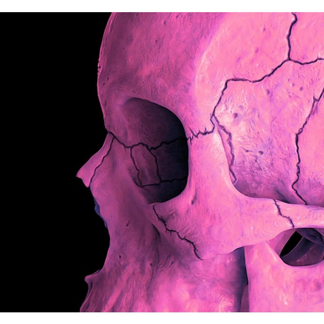 Mr Strange, Death in Pink, 2021, Giclée on Aludibond For Sale - Image 4 of 6