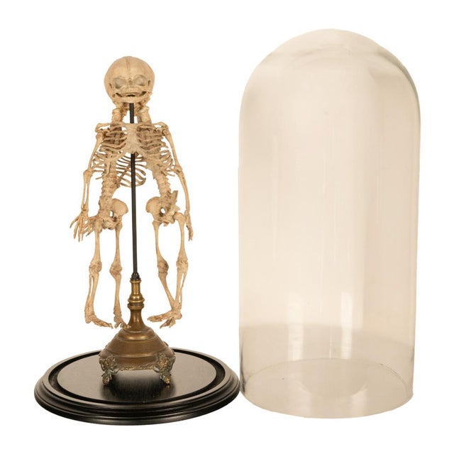 Mid 19th Century Antique 19thC Anatomical Conjoined Syncephalus Twins Skeleton Medical Model 1860 For Sale - Image 5 of 17
