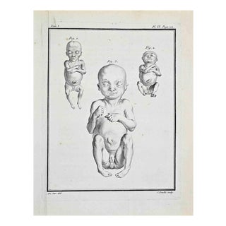 Jacques de Seve, Anatomical Studies, Etching, 1771 For Sale