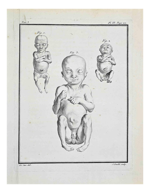 Jacques de Seve, Anatomical Studies, Etching, 1771