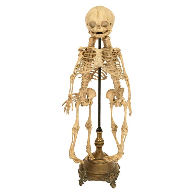 Antique 19thC Anatomical Conjoined Syncephalus Twins Skeleton Medical Model 1860 For Sale - Image 15 of 17