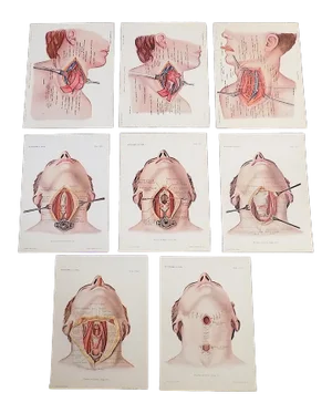 Antique Surgical Lithographs-Anatomy-Head/Neck Surgery-Set of 8
