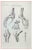 Ottavio Muzzi, Joint Diseases, Lithograph, 1843 For Sale