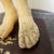 Nude Man Acupuncture Model Chinese 1950s For Sale - Image 10 of 13