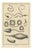 Antonio Baratti, Truss Springs and Bladder Syringe, Diderot Chirurgie Plate Vii, 1772, Engraving For Sale