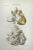 Heart Disease is a lithograph hand colored by Ottavio Muzzi for the edition of Antoine Chazal, Human Anatomy, Printers...
