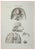 Ottavio Muzzi, Brain Diseases, Lithograph, 1843 For Sale