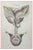 Ottavio Muzzi, Uterus Diseases, Lithograph, 1843 For Sale