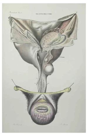 Ottavio Muzzi, Uterus Diseases, Lithograph, 1843