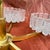 Vintage Icicle Glass Hanging Lamp from Doria Leuchten, 1960s For Sale - Image 14 of 17