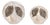 LED Frosted Pine Cone Globe (Set of 2) For Sale