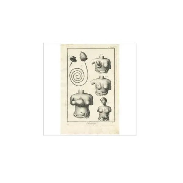 Diderot, Medical Print Pl. XXVIII, 1760, Print For Sale - Image 4 of 5