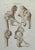 Bone Disease is a lithograph hand colored by Ottavio Muzzi for the edition of Antoine Chazal, Human Anatomy, Printers...