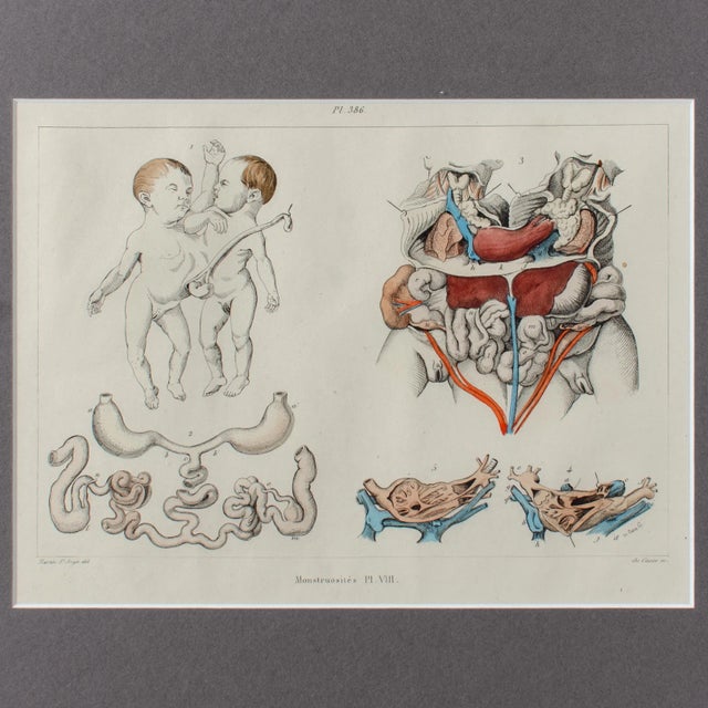 Paint Monstruosites, Engravings From Isidore Geoffrey Sainte-Hilaire, Paris C. 1832 - Set of 4 For Sale - Image 7 of 13