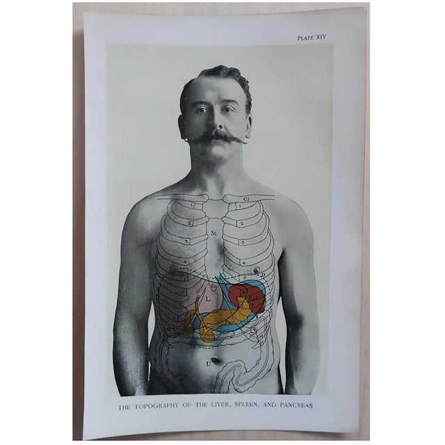 Vintage Medical Prints, 1900, Set of 8, Paper For Sale - Image 9 of 10