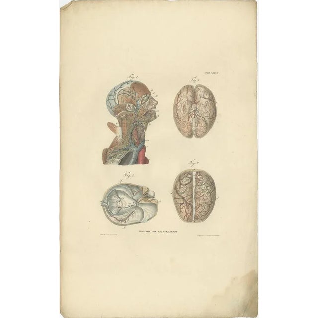 Set of 13 antique anatomy prints of vessels and the lymphatic system of the human body. These prints originate from...