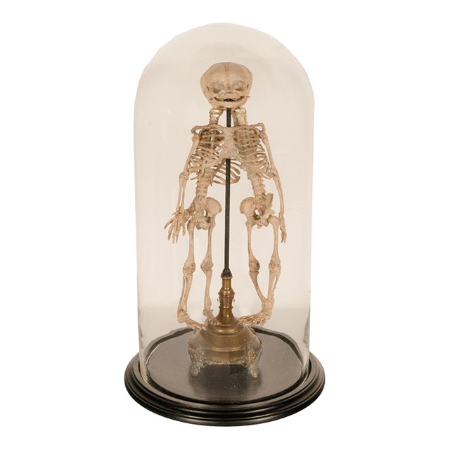 Antique 19thC Anatomical Conjoined Syncephalus Twins Skeleton Medical Model 1860 For Sale