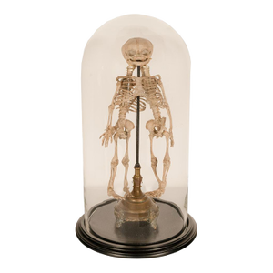 Antique 19thC Anatomical Conjoined Syncephalus Twins Skeleton Medical Model 1860