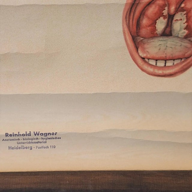 Vintage Training Poster with Childhood Illnesses, 1930-1940 For Sale - Image 4 of 7