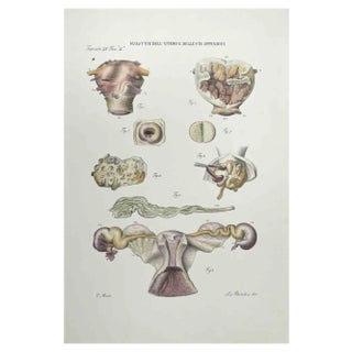 Ottavio Muzzi, Diseases of the Uterus and its Appendages, Lithograph, 1843 For Sale