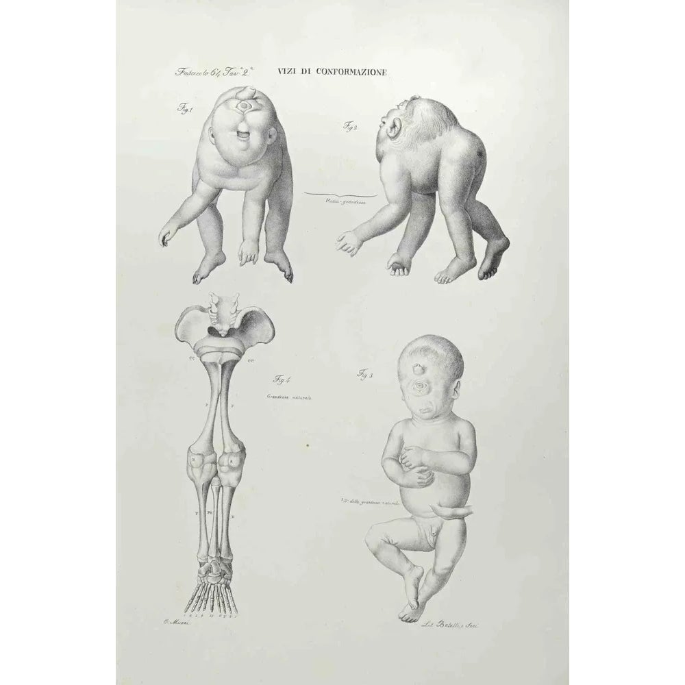 Ottavio Muzzi, Conformation Defects, Lithograph, 1843 | Chairish