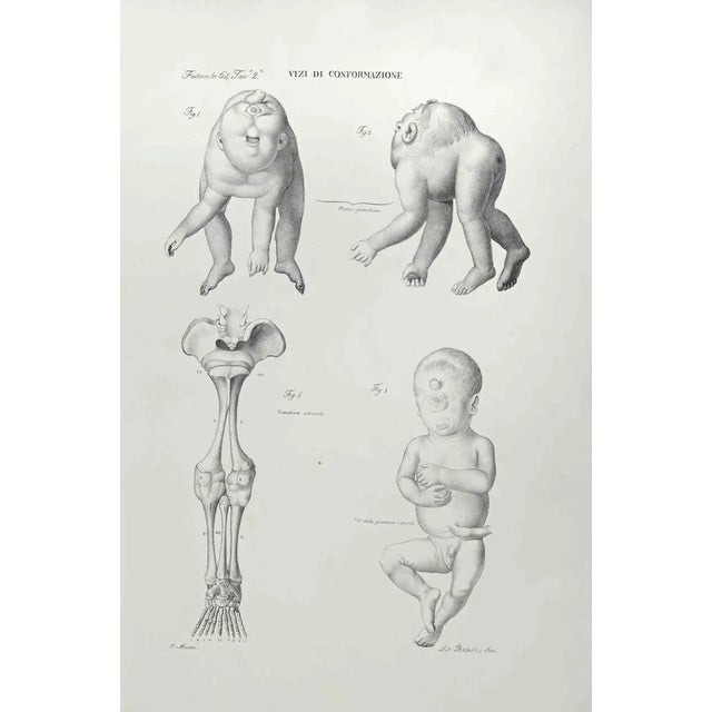 Ottavio Muzzi, Conformation Defects, Lithograph, 1843 For Sale