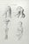 Ottavio Muzzi, Conformation Defects, Lithograph, 1843 For Sale