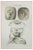 Ottavio Muzzi, Brain Diseases, Lithograph, 1843 For Sale