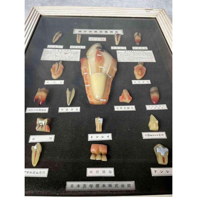 Japanese Dental Teaching Display with Anatomical Models, 1920s For Sale - Image 17 of 18