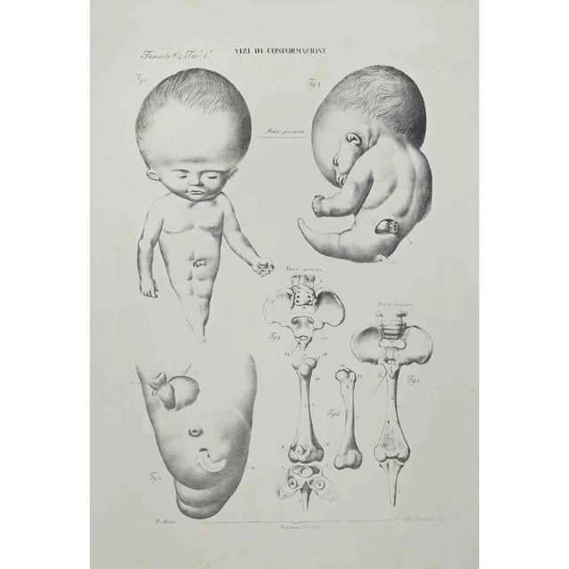 Ottavio Muzzi, Conformation Defects, Lithograph, 1843 For Sale