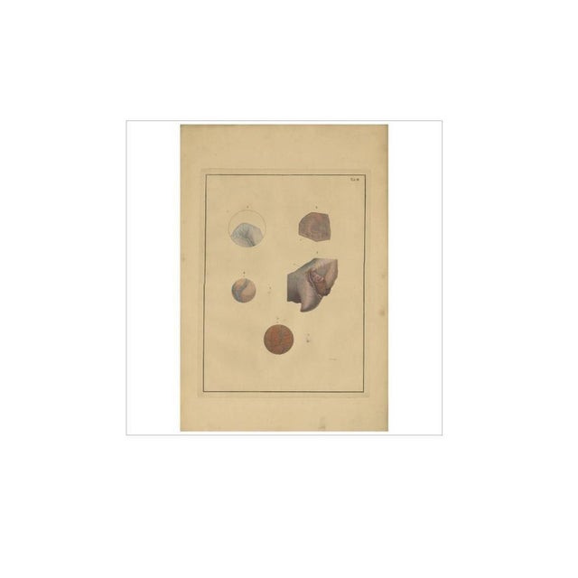 F.D. Reisseisen, Lungs, 1822, Paper For Sale - Image 4 of 5