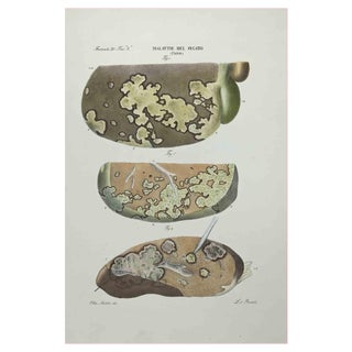Ottavio Muzzi, Liver Diseases, Lithograph, 1843 For Sale
