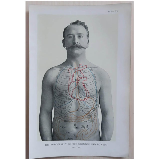 Vintage Medical Prints, 1900, Set of 8, Paper For Sale - Image 8 of 10