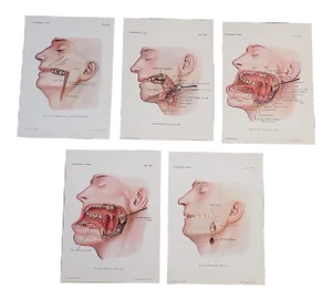 Antique Surgical Lithographs-Anatomy-Head/Neck Surgery-Set of 5