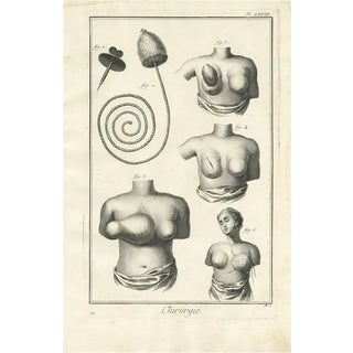 Diderot, Medical Print Pl. XXVIII, 1760, Print For Sale