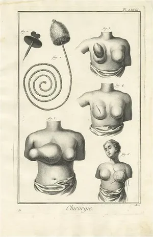 Diderot, Medical Print Pl. XXVIII, 1760, Print